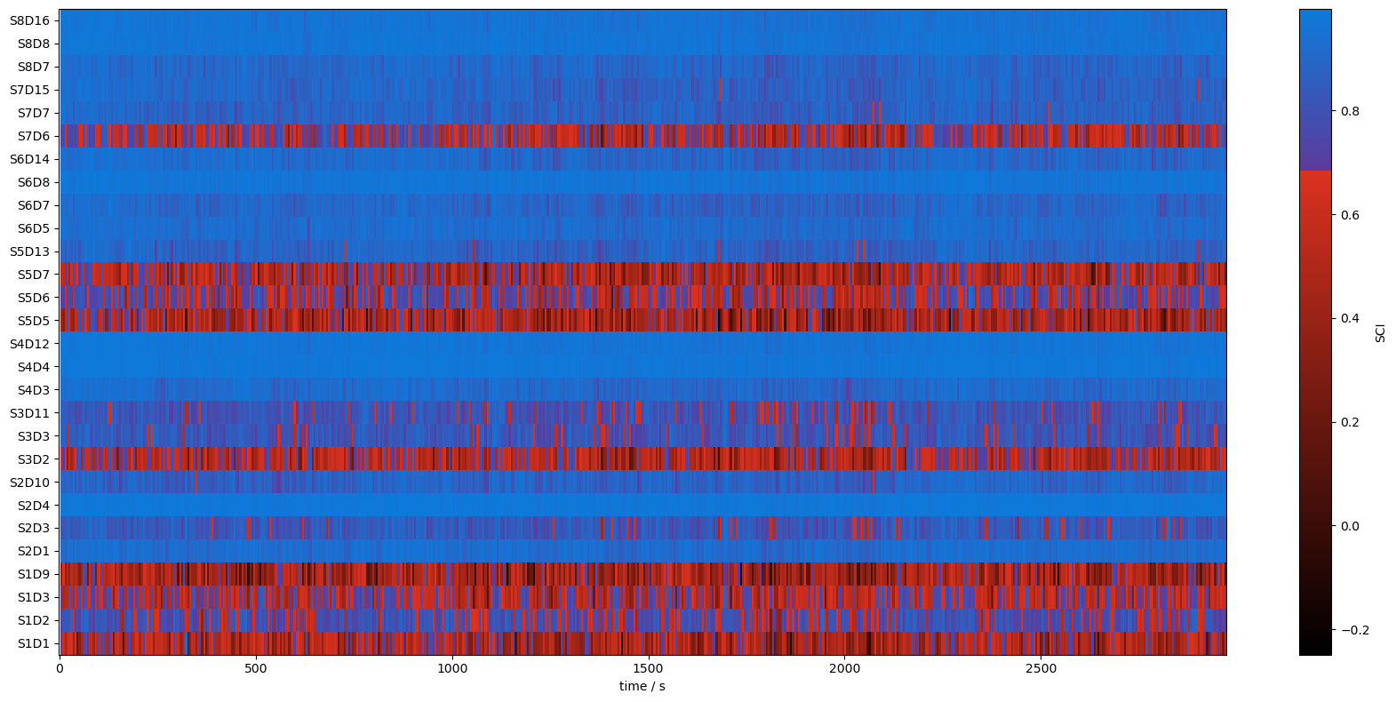 ../_images/examples_scalp_coupling_index_19_1.png