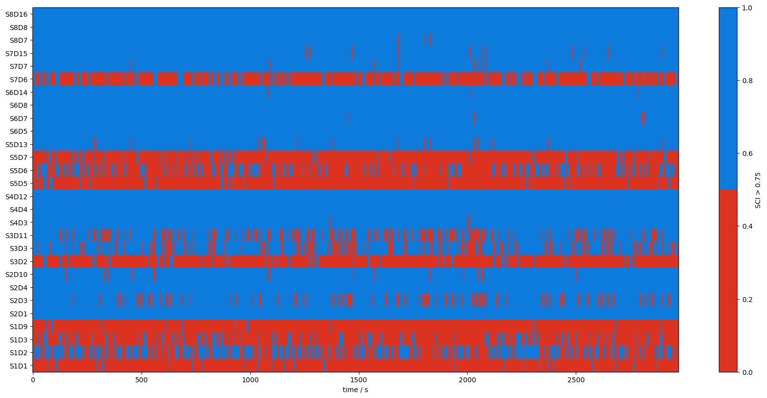 ../_images/examples_scalp_coupling_index_19_2.png