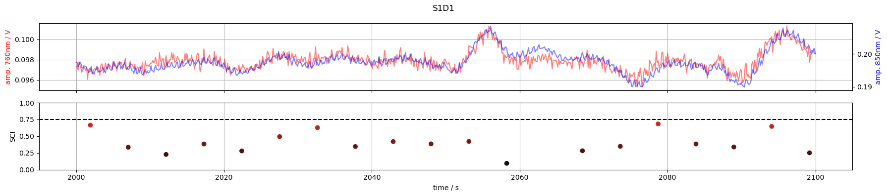 ../_images/examples_scalp_coupling_index_21_1.png