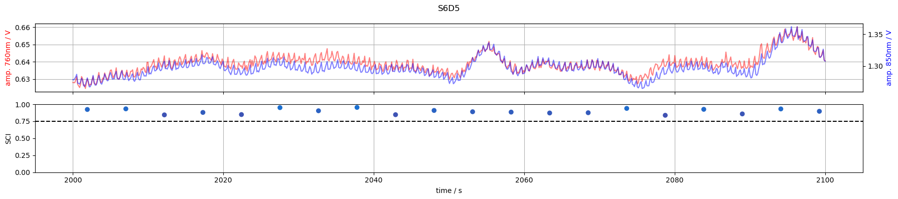 ../_images/examples_scalp_coupling_index_21_4.png